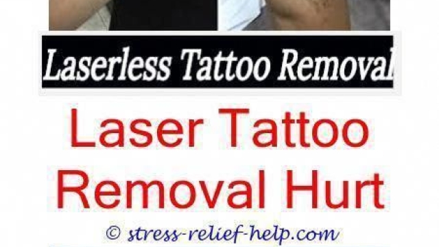 Tattoo Removers – What Works And What Doesn’t